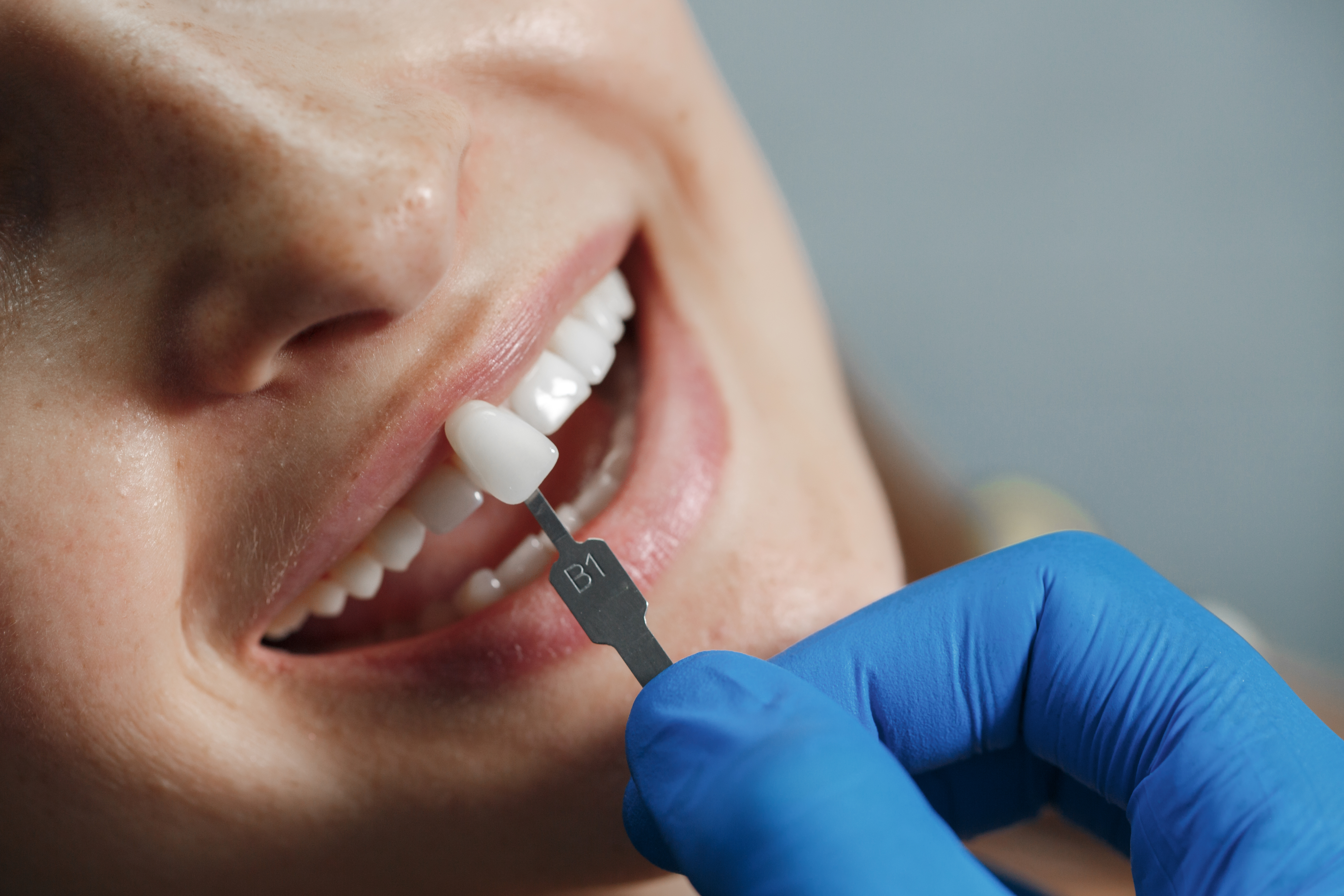 Dental Prosthetics