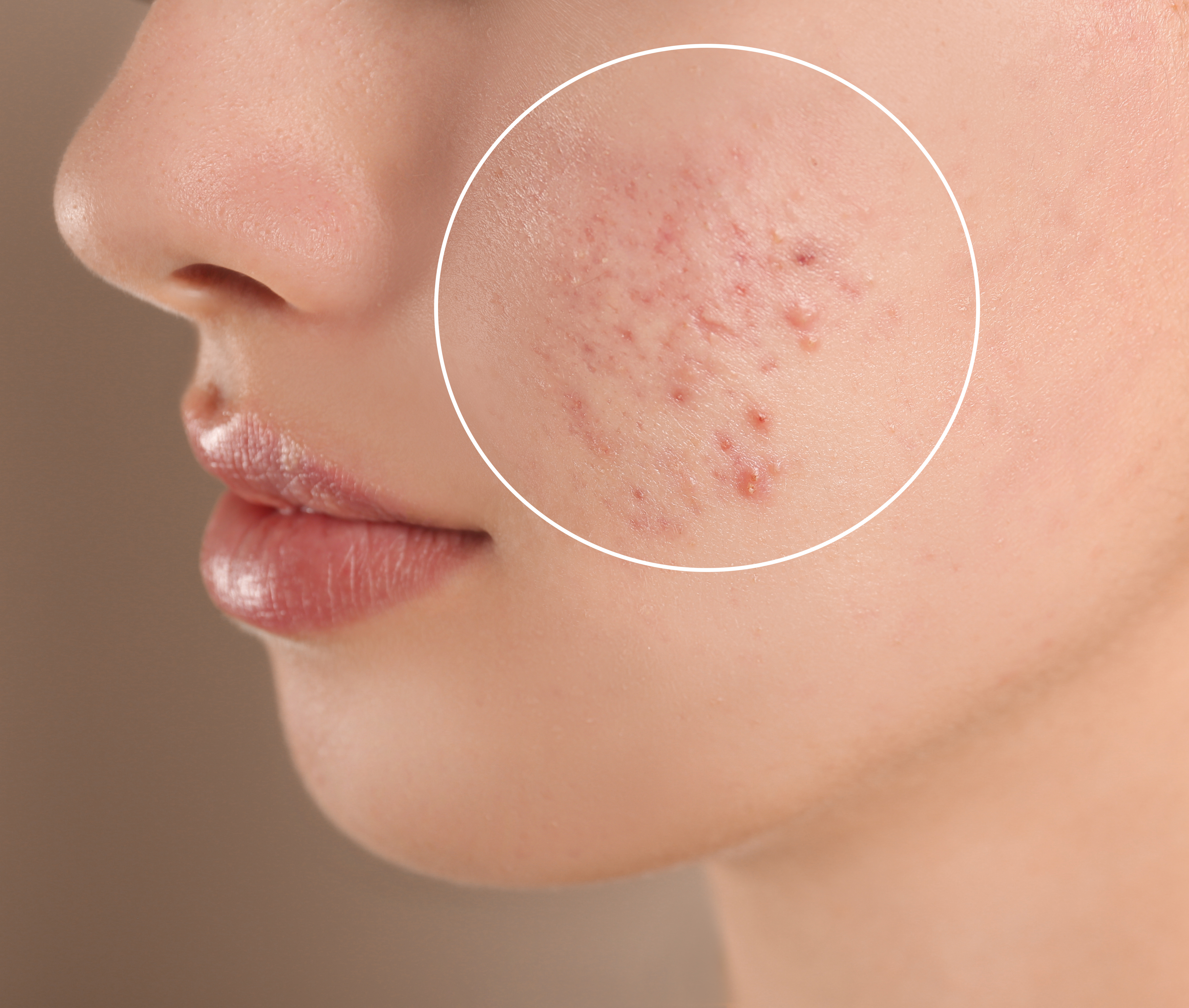 علاجات التجميل