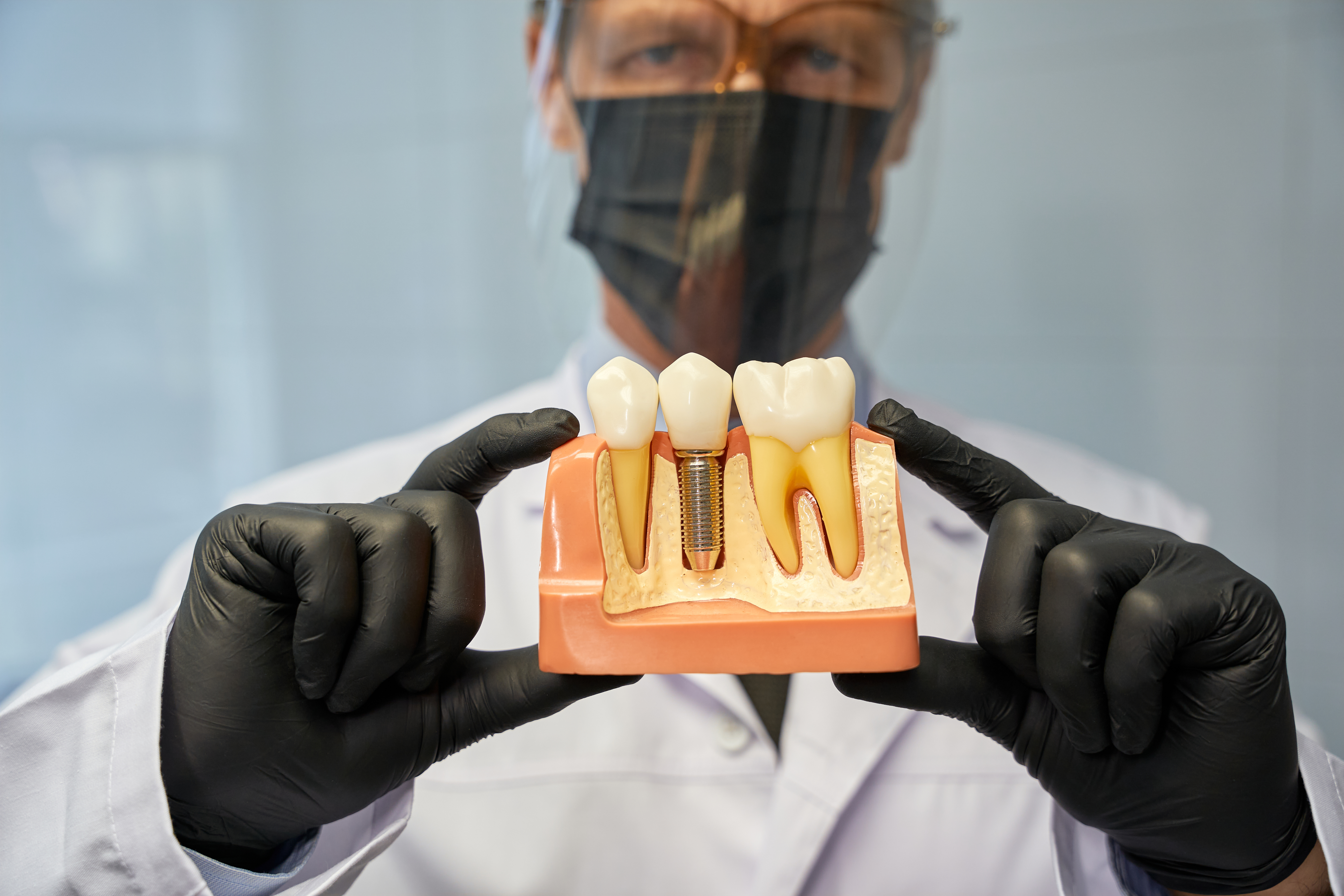 Root Canal Treatment